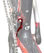 Picture of FORCE CHAIN CATCHER